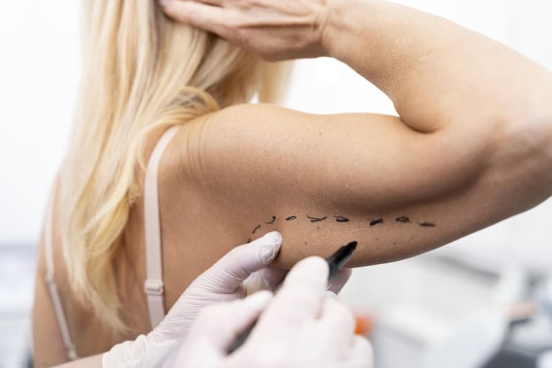 Braquioplastia en Mazatlán, México